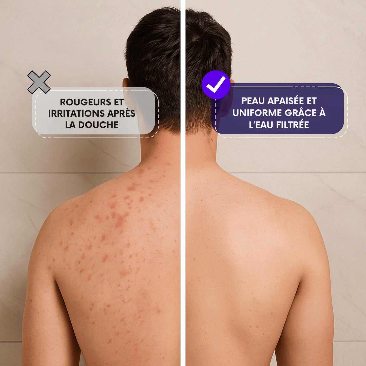 Aquapure - Anti Calcaire